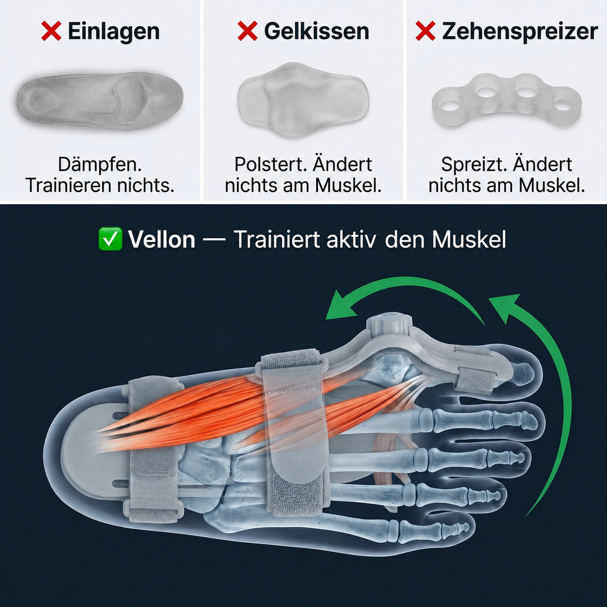 Hallux valgus foot illustration